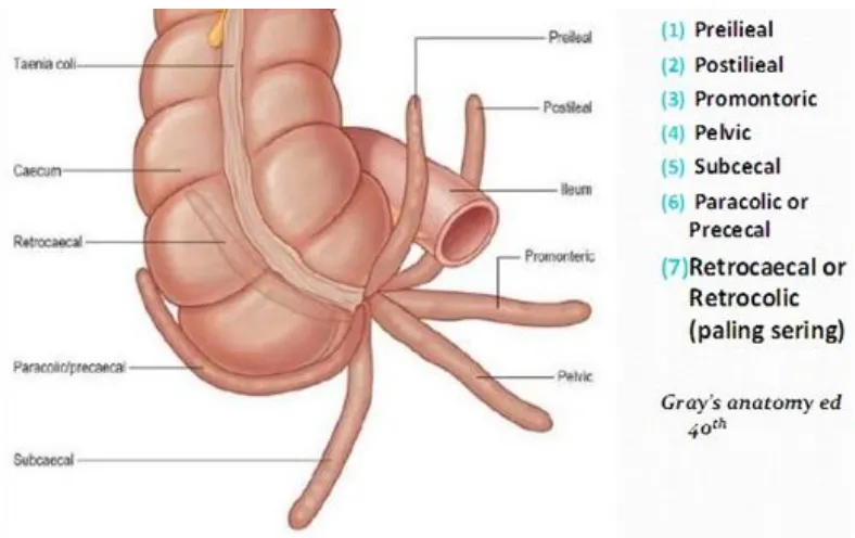 Fig: 1  Various position of appendix 