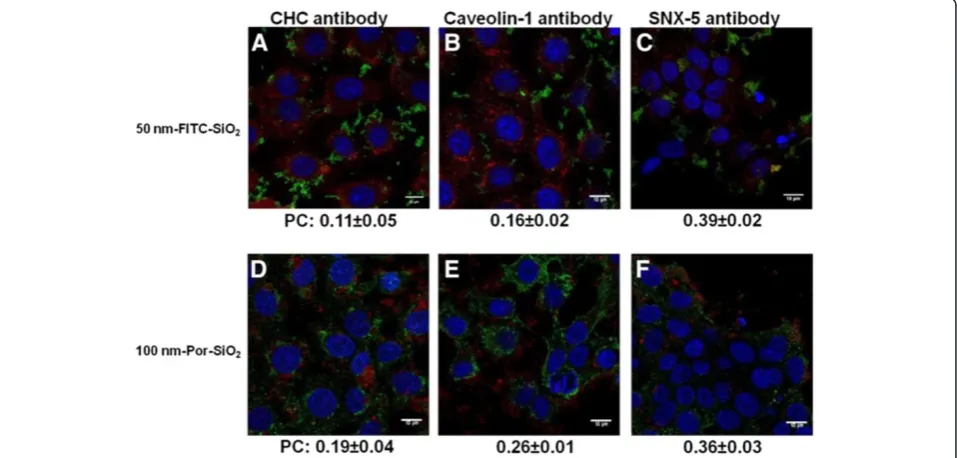 Figure 10 Colocalization of SiO2 NPs with proteins specific for different endocytotic vesicles analyzed by confocal microscopy