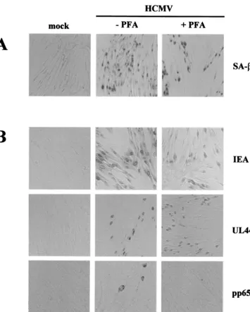 FIG. 5. IE and early (E) genes are per se sufﬁcient to induce SA-�starvation and treated with PFA immediately after HCMV infection (MOI, 5) or were not treated