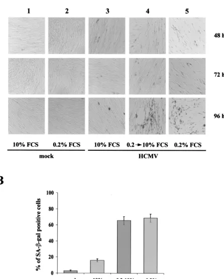 FIG. 2. Differential SA-�culture conditions were infected with HCMV (MOI, 1) and stained for SA-mock-infected cells cultured in DMEM–10% FCS; column 2, mock-infected cells cultured in DMEM–0.2% FCS; column 3, HCMV-infected cellscultured in DMEM–10% FCS; co