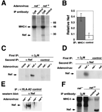 FIG. 2. Nef interacts with MHC-I in vivo. (A) MHC-I coimmunoprecipitates a 27-kDa protein in Nef-expressing cells