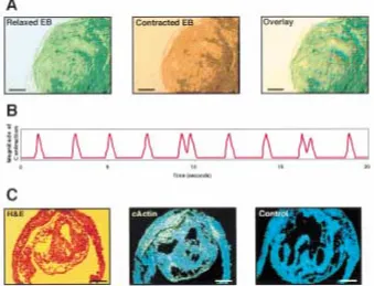 Fig. 4.Cardiac muscle differentiation depictedbryoid body. Shown is a video micrograph of apulsing EB in a relaxed or contracted state