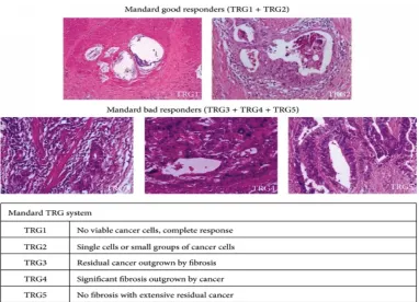 Figure 10: Tumour regression grading systems  