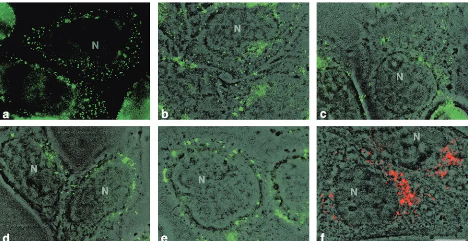 FIG. 7. Conventional micrographs of cells infected with PV M1 and S2. (a to e) FISH was performed with a FITC-labeled probe of 2,980 ntat different times p.i