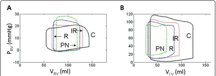 Figure 3 Comparison of Model Ventricular Pressure-Volume Loops. Comparing modeled ventricularfunction curves of normal physiology (C, solid black line) with LVDD due to impaired LV wall relaxation (IR,dotted red line), increased LV wall stiffness (R, dashe