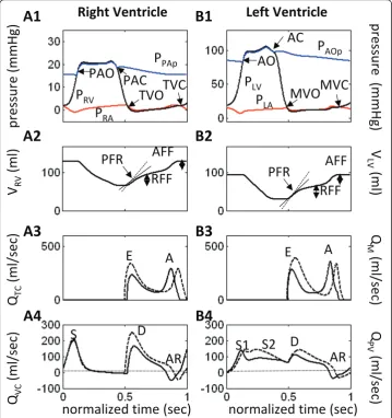 Figure 4 Model Waveforms for Impaired Relaxation Case. Model-generated pressure, volume and flowwaveforms for the impaired relaxation (IR) case