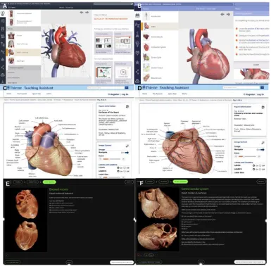 Figure 2: Example screen of 2A) and 2B) AnatomyTV, 2C) and 2D) Thieme and 2E) and 2F) An@tomedia Online computer programs used for the teaching of gross anatomy in RBM1100 Functional Anatomy of the Trunk 