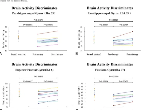 Fig 3. Effects of antithyroid treatment on regional cerebral activity (FDR-corrected at P � .05)