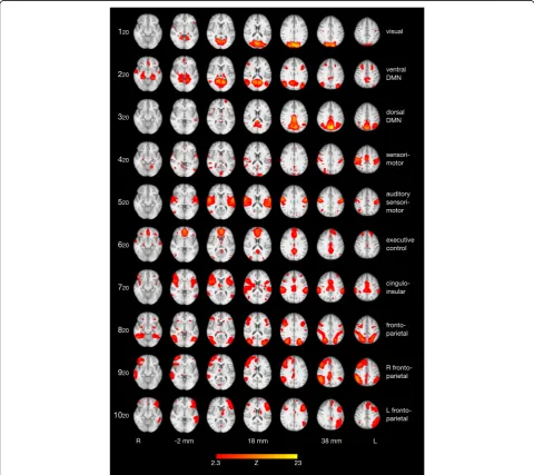 Fig. 3 Ten resting state networks (RSNs) identified in a sample of 38 adults with ADHD, corresponding to the 10 RSNs found by Smith et al