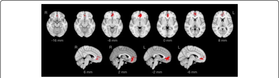Fig. 4 Regions of decreased functional connectivity in older individuals with ADHD within the executive control network (IC 6 in Fig.significant cluster covers parts of the bilateral anterior cingulate cortex and the bilateral paracingulate cortex (cluster