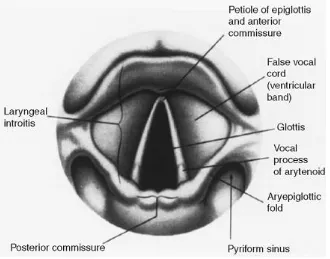 Figure showing Laryngoscopic view 