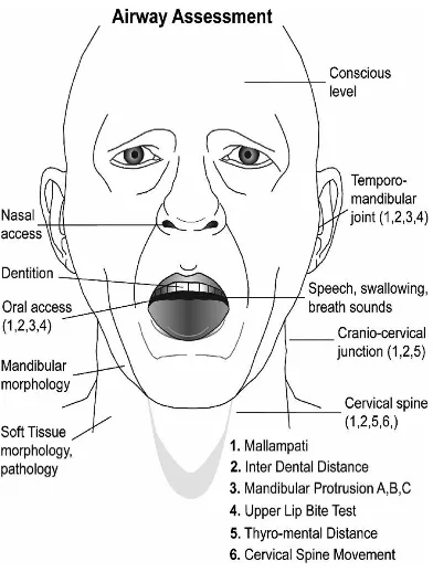 Figure showing Airway Assessment Points 