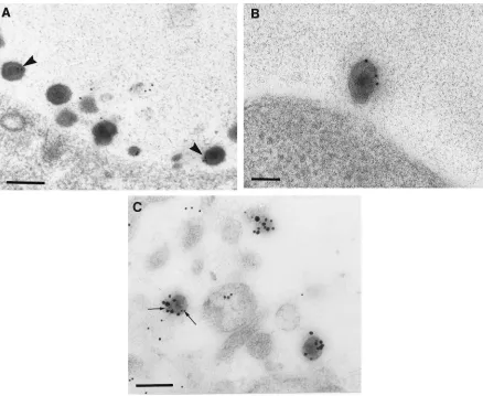 FIG. 7. Immunolabeling with Golgi markers of extracellular HSV-1 particles. (A and B) Extracellular virions labeled with the mannosidase II(arrowheads), which is indicative of Golgi (A), or TNG38, which is indicative of the TGN (B)