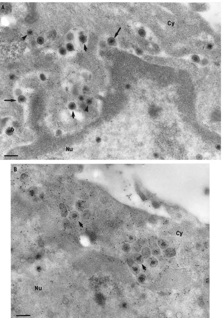FIG. 9. Immunogold labeling for tegument proteins of HSV-1-infected neurons treated with BFA