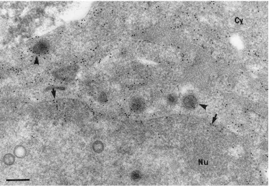 FIG. 10. Immunogold labeling for gH of HSV-1-infected neurons treated with BFA. Label for gH is present along the nuclear membrane(arrows), throughout the cytoplasm of the cell body, and on enveloped virions (arrowheads)