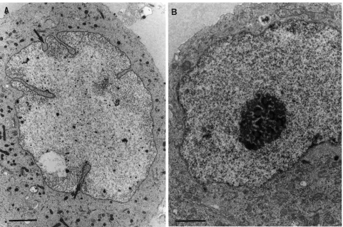 TABLE 1. Time course quantitative TIEM analysis of VP13/14immunolabeling on intranuclear, cytoplasmic, and extracellularHSV-1 capsids at various times postinfection