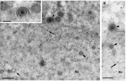 FIG. 2. Immunogold labeling for tegument proteins of HSV-1 nucleocapsids budding through the nuclear membranes (12 hpi)