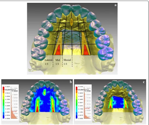 Fig. 6 Pattern of palatal trueness of intraoral scans. a. Conceptual diagram of pattern of trueness in the palatal region