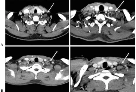 Fig.3,