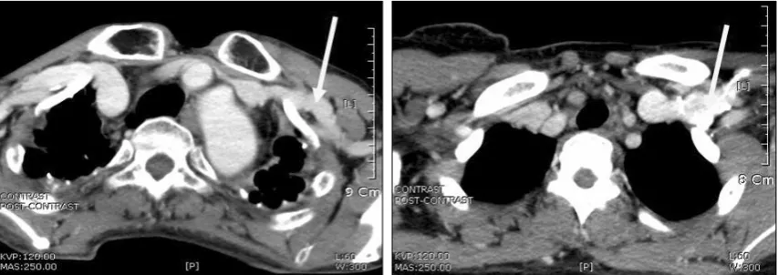 Fig. 5. Comparison of images according to injection site (left: right arm injection; right: left arm injection)