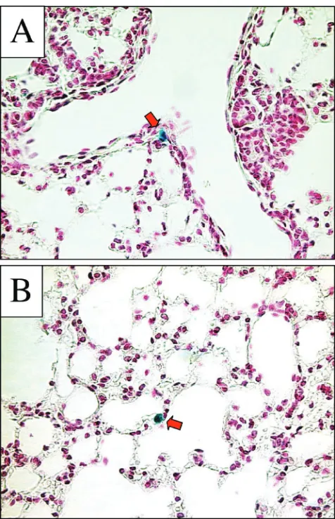 FIG. 7. RRV glycoprotein-pseudotyped FIV vector transduces air-way cells inefﬁciently following pulmonary delivery