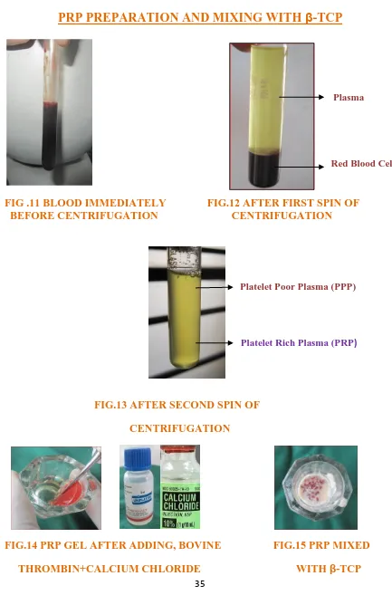 FIG .11 BLOOD IMMEDIATELY               FIG.12 AFTER FIRST SPIN OF   BEFORE CENTRIFUGATION                           CENTRIFUGATION      