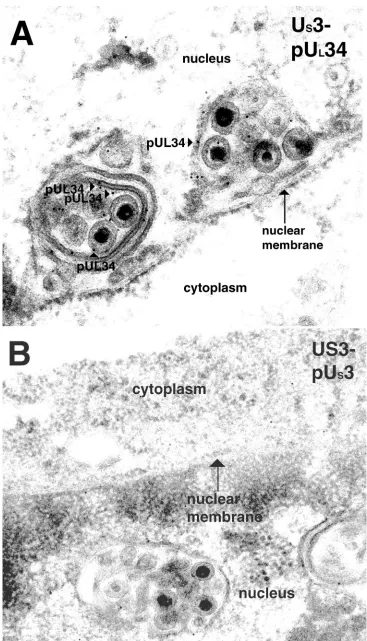 FIG. 7. Scanned digital electron micrograph of thin sections of UBound antibody is indicated with pUS3-null mutant virus-infected cells incubated with anti-UL34 chicken IgY.34-labeled arrowheads, and the nucleus and cytoplasm are labeled