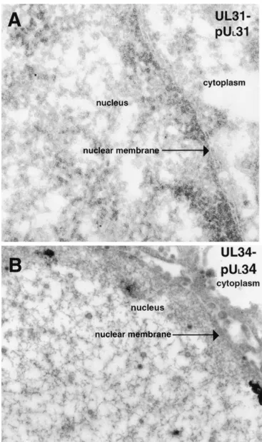 FIG. 2. Scanned digital electron micrograph of Uinfected thin sections of Vero cells (B) harvested and ﬁxed late in infection (14 to 18 hpi)