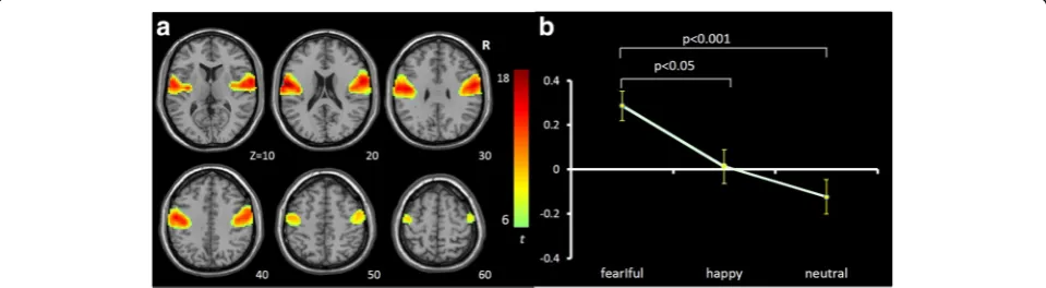Fig. 3 Task-related modulation of IC54 (visual network). a Red-yellow-blue color on T1 template in MNI space shows the spatial distribution ofIC54