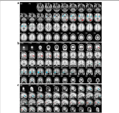 Fig. 2 The decreased (blue) and increased (red) rCBF foci in the reconstructed transverse slices (a), coronal slices (b) and sagittal slices (c) of MDDpatients, which was analyzed by SPM and eZIP and viewed by xjView toolbox