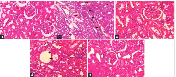 Figure 4: Photomicrographs of histopathological studies of kidney; (a) normal group, (b) disease control, (c) standard group, (d) ethanolic extract of Crossandra infundibuliformis leaves and stems (ECILS) (200 mg/kg), (e) ECILS (400 mg/kg)