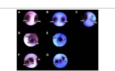 Fig. 4 Bronchoscopic validation questionnaire responses in segmented bar chart
