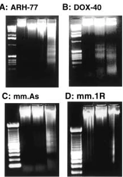 Fig. 3.Induction of DNA fragmentation by 0,myeloma (MM) cells.feature of apoptosis, was induced in: (A) ARH-77treated with (C) MM.AS, (D) MM.1R