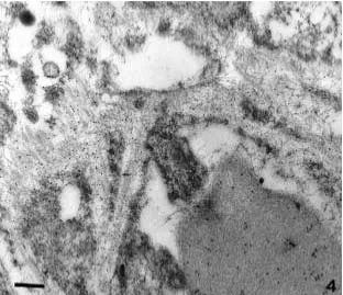 Fig. 5.Fibril formation of hu-man islet amyloid polypeptide(IAPP) assayed by thioﬂavin T spectroscopy