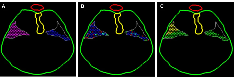 Figure 10Initial conditionsmouse embryo. The right side of each image models normal development; the left side models the precursor defect in the PPF Initial conditions