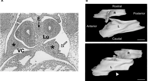 Figure 6PPF defect as a precursor to CDH in the rodent nitrofen modelexposed to nitrofen, with a posterior defect (hollow arrow) in the left PPF (star)
