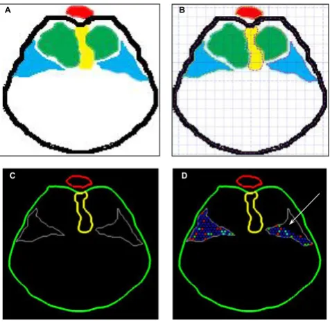 Figure 8Input of experimental images into modeling softwarecal boundaries by the Nudge++™ modeling software (green – body wall, red – aorta, yellow – esophageal mesentery, white – PPF)