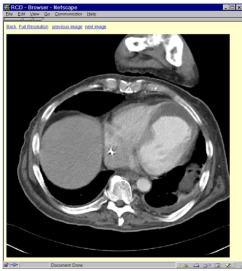 Fig. 3 provides a detailed view of a single image in thesystem. By means of navigation links all images associat-ed with a case can be viewed in high resolution.