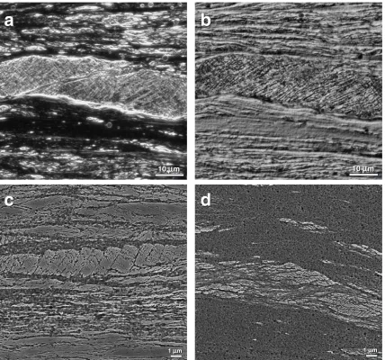Fig. 4Diametric section views of a Ni3Al disc deformed by 1 turn of HPT: (a) dark-ﬁeld (DF) and (b) diﬀerential-interference contrast(DIC) OM images of the disc edge region; (c) central-area and (d) edge SEM images.