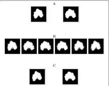 Figure 5 The second simulation scheme: A(left) andgenotypes, “small” QTL controls differences in leaf shape amongdifferent plants from cultivars of cucurbit plants