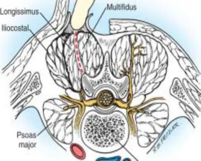 Fig -3: Paraspinal muscles 