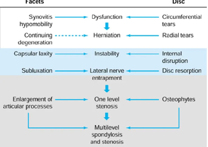 Table-4: Pathophysiology Of Spinal Stenosis 