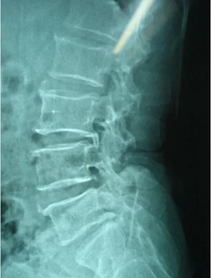 Fig.9: lateral view 