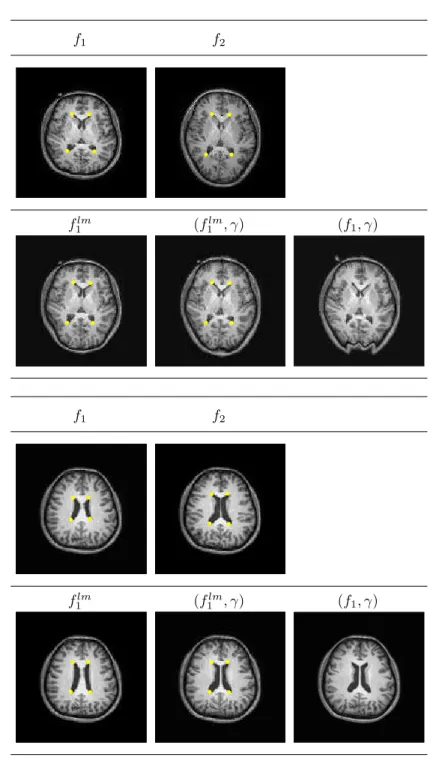 Figure 1.14 Two examples of brain image registration with landmarks. In each experiment, the top row shows the original images f 1 and f 2 , and in the bottom row, the first column shows the deformed images f 1 lm using only landmarks; the second column sh