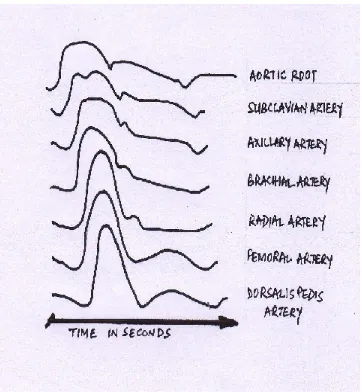 Figure 1:Variation in morphology of the arterial waveform from the aortic root to dorsalis 