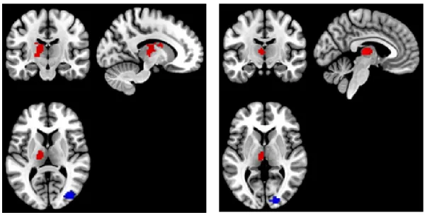Figure 2.7: clusters of significant correlation (red) and anti-correlation (blue) between BOLD and alpha power spectrum