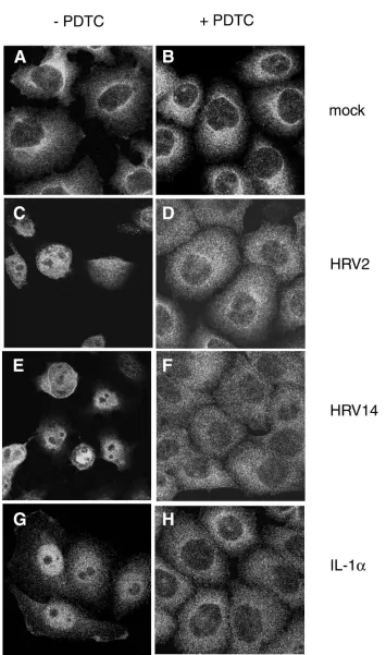 FIG. 10. PDTC inhibits HRV- and IL-1�cells. Left column, cells without PDTC; right column, PDTC-treated cells