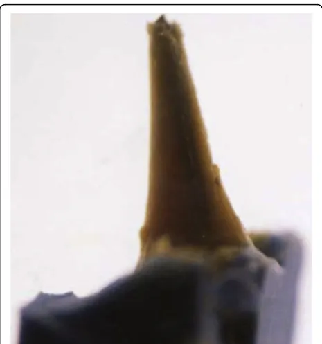 Figure 1 A typical acquired image in the MD Dimension for amaxillary central incisor.