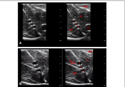 Fig. 12 Ultrasound image of the interscalene brachial plexus model (a). Ultrasound image of needle placement (b)