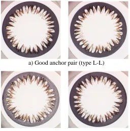 Figure 2. Example of good and bad anchor pairs 